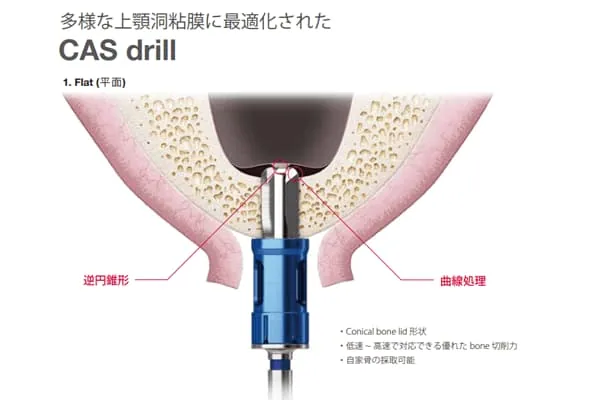 ソケットリフト