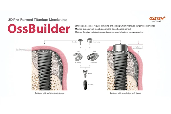OssBuilder