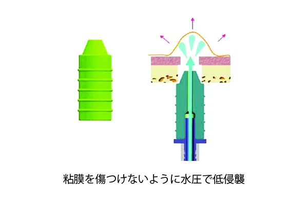 水圧で粘膜を挙げるイメージ